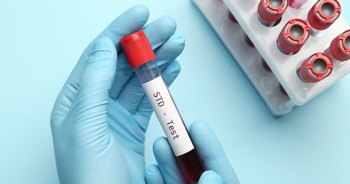 Depistage-ITSS-6-bioanalyse