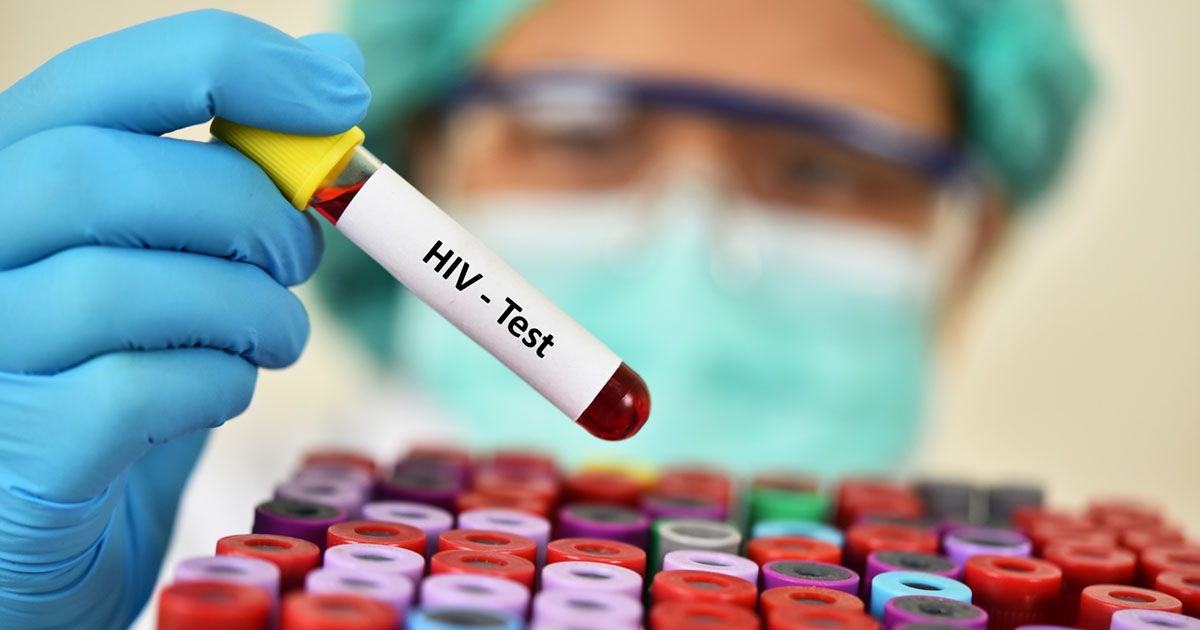 Depistage-ITSS-7-bioanalyse Depistage-ITSS-7-bioanalyse